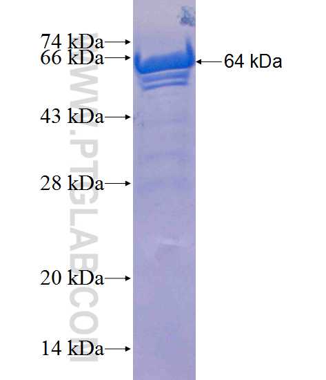 TBC1D5 fusion protein Ag10991 SDS-PAGE