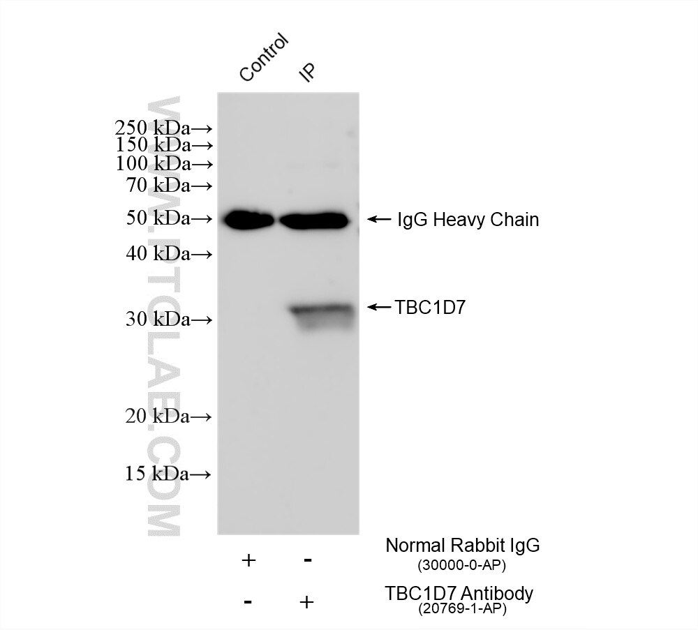 IP result of anti-TBC1D7 (IP:20769-1-AP, 4ug; Detection:20769-1-AP 1:500) with HeLa cells lysate 1200 ug. Immunoprecipitation (IP) experiment of HeLa cells using TBC1D7 Polyclonal antibody (20769-1-AP)