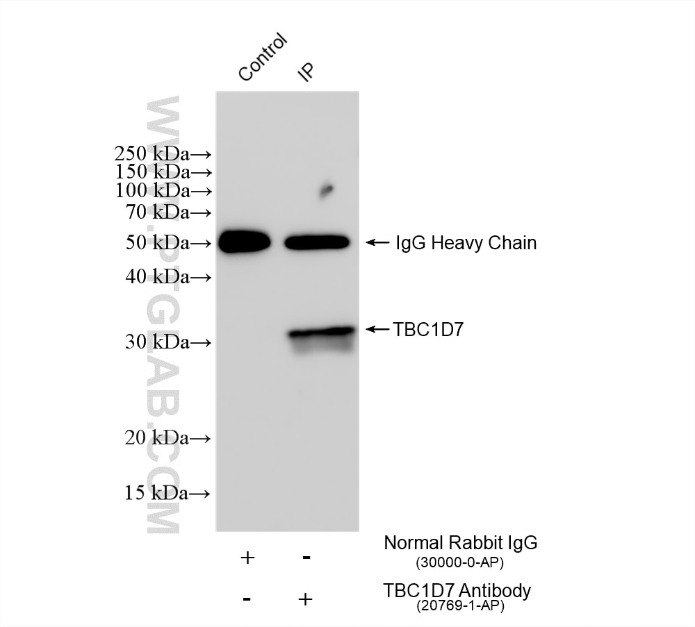 IP result of anti-TBC1D7 (IP:20769-1-AP, 4ug; Detection:20769-1-AP 1:500) with Neuro-2a cells lysate 1440 ug. Immunoprecipitation (IP) experiment of Neuro-2a cells using TBC1D7 Polyclonal antibody (20769-1-AP)
