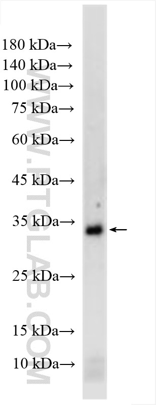 human placenta tissue were subjected to SDS PAGE followed by western blot with 20769-1-AP (TBC1D7 antibody) at dilution of 1:1000 incubated at room temperature for 1.5 hours. Western Blot (WB) analysis of human placenta tissue using TBC1D7 Polyclonal antibody (20769-1-AP)