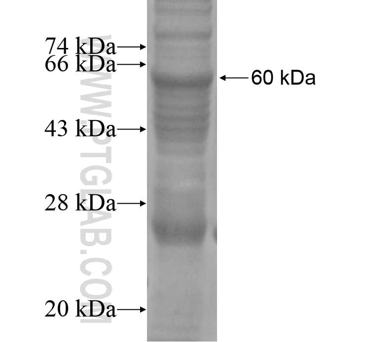 TBC1D7 fusion protein Ag14756 SDS-PAGE