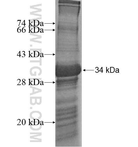 TBC1D7 fusion protein Ag15635 SDS-PAGE