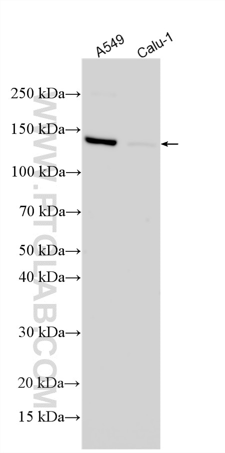WB analysis using 33583-1-AP Western Blot (WB) analysis of various lysates using TBC1D8 Polyclonal antibody (33583-1-AP)