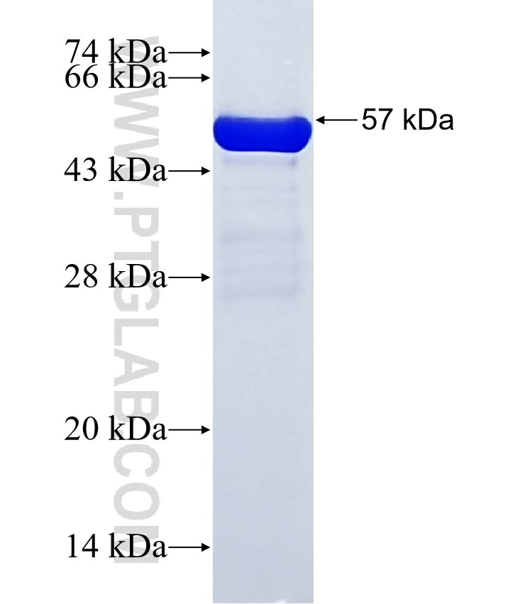 TBC1D8 fusion protein Ag35398 SDS-PAGE TBC1D8 fusion protein Ag35398 SDS-PAGE