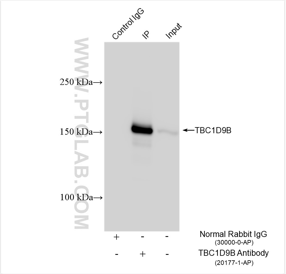 Immunoprecipitation (IP) experiment of HEK-293 cells using TBC1D9B Polyclonal antibody (20177-1-AP)