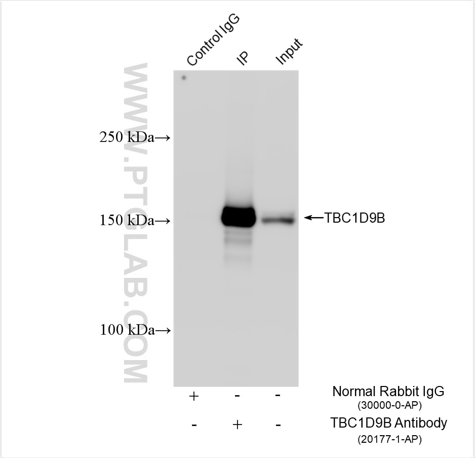 Immunoprecipitation (IP) experiment of Jurkat cells using TBC1D9B Polyclonal antibody (20177-1-AP)