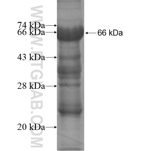 TBC1D9B fusion protein Ag14019 SDS-PAGE