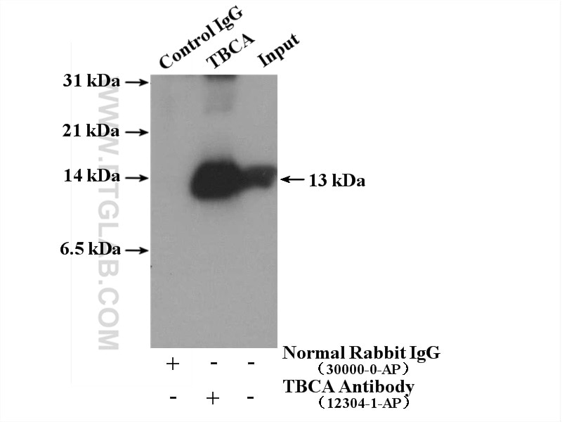 Immunoprecipitation (IP) experiment of HeLa cells using TBCA Polyclonal antibody (12304-1-AP)