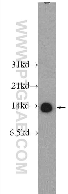 Western Blot (WB) analysis of HeLa cells using TBCA Polyclonal antibody (12304-1-AP)
