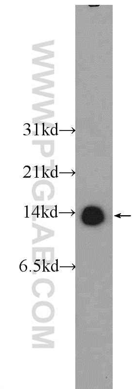 Western Blot (WB) analysis of HeLa cells using TBCA Polyclonal antibody (12304-1-AP)