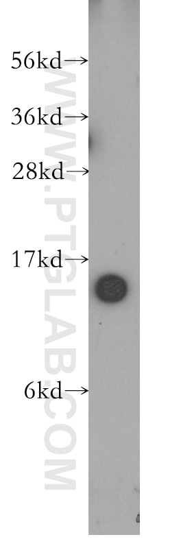 Western Blot (WB) analysis of human brain tissue using TBCA Polyclonal antibody (12304-1-AP)