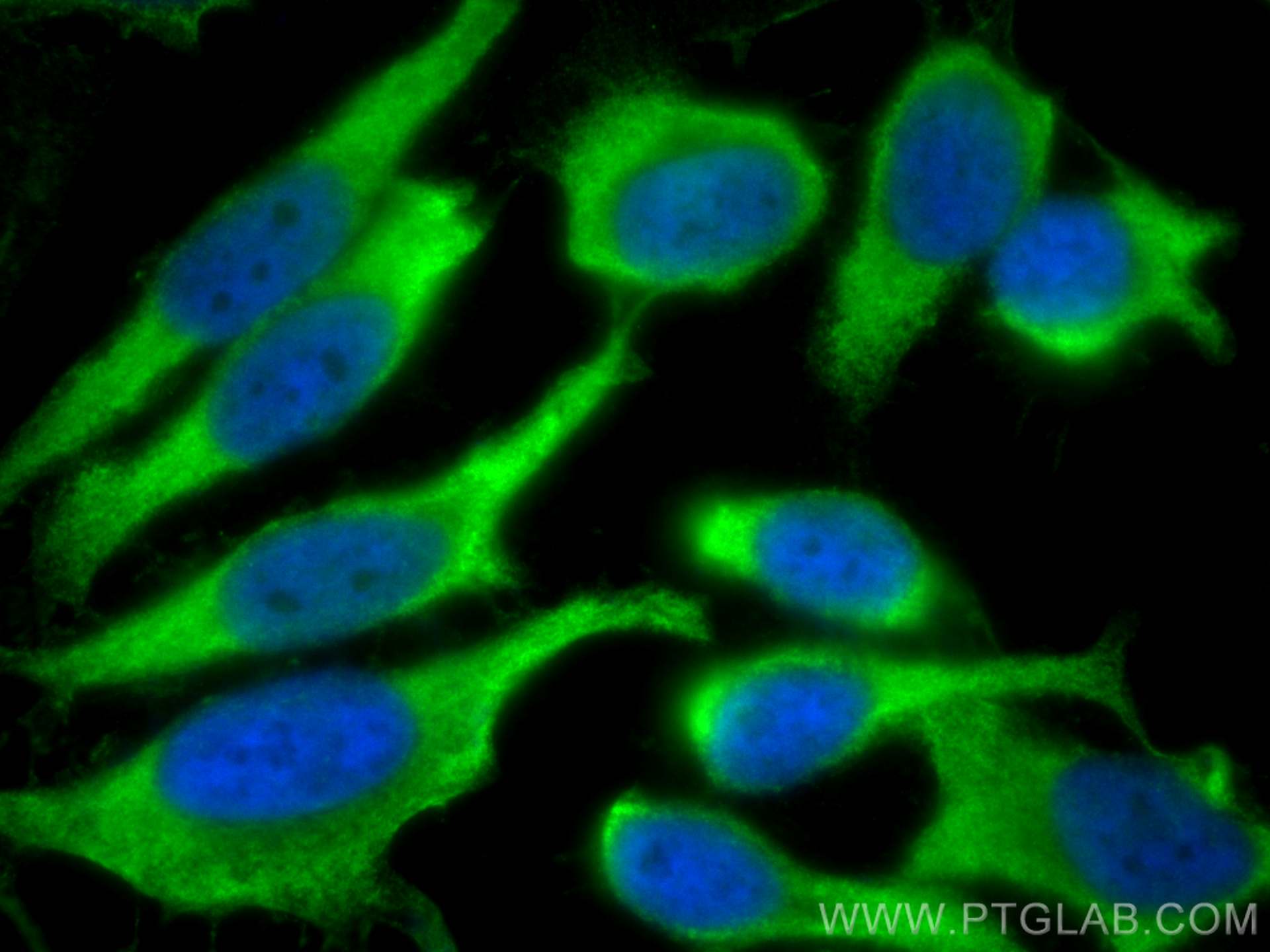 Immunofluorescence (IF) / fluorescent staining of HeLa cells using TBCB Polyclonal antibody (15782-1-AP)