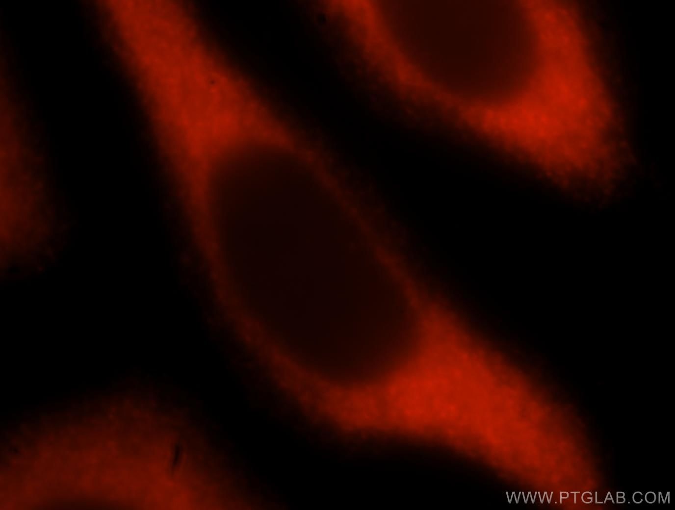 Immunofluorescence (IF) / fluorescent staining of HeLa cells using TBCB Polyclonal antibody (15782-1-AP)