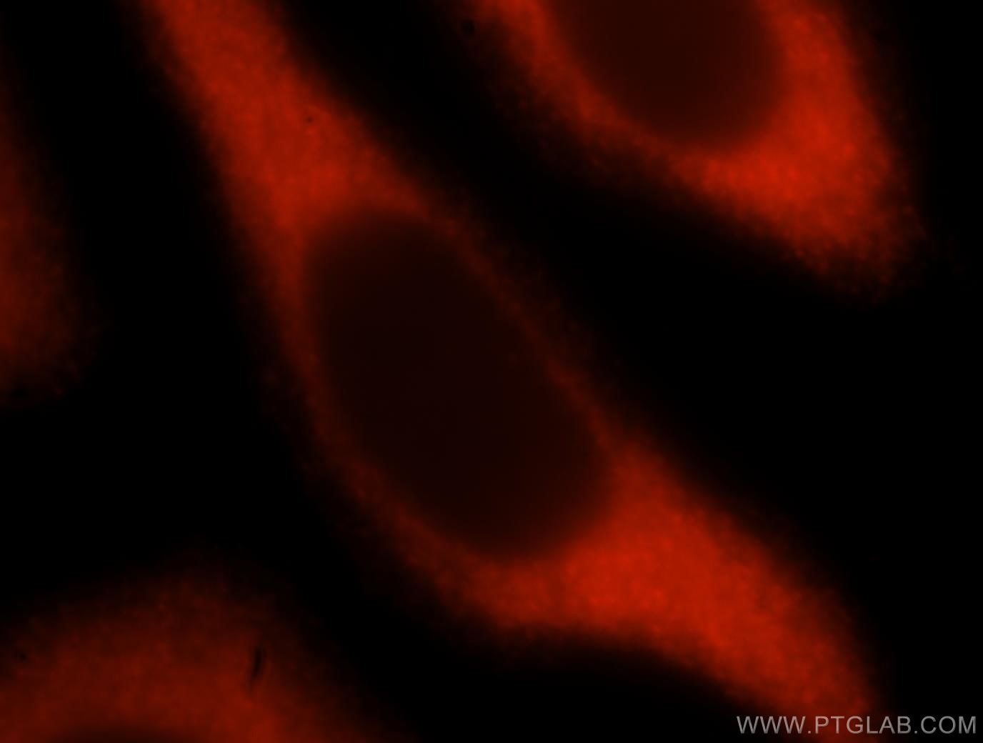 IF Staining of HeLa using 15782-1-AP