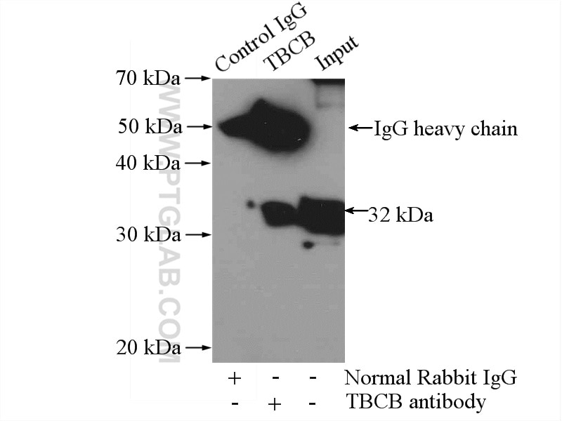 Immunoprecipitation (IP) experiment of HeLa cells using TBCB Polyclonal antibody (15782-1-AP)