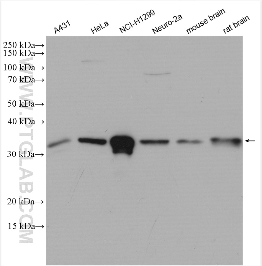 Western Blot (WB) analysis of various lysates using TBCB Polyclonal antibody (15782-1-AP)
