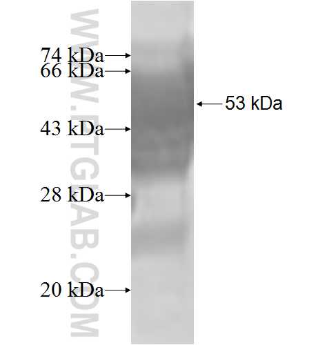 TBCB fusion protein Ag8473 SDS-PAGE