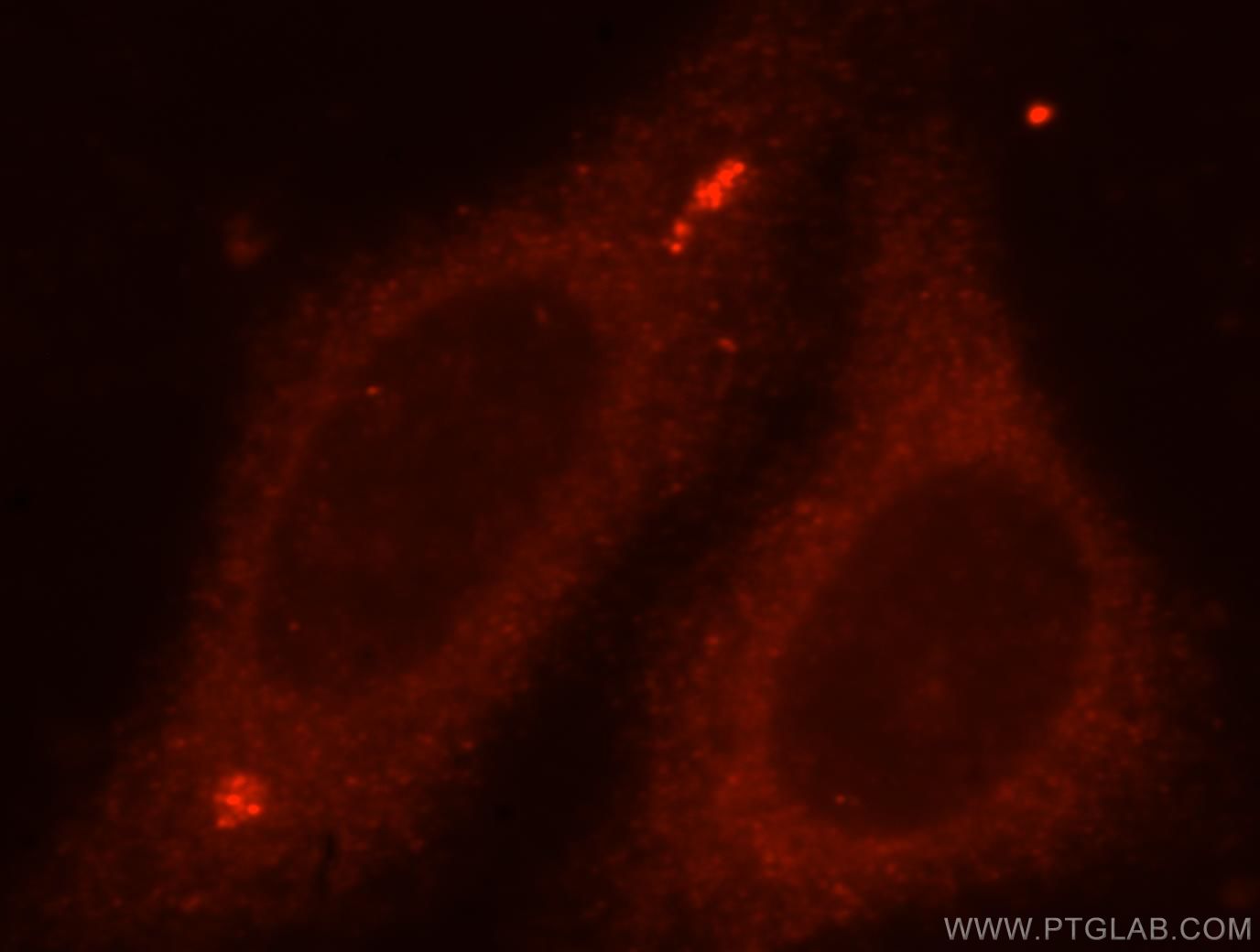 Immunofluorescence (IF) / fluorescent staining of HepG2 cells using TBCC Polyclonal antibody (15917-1-AP)