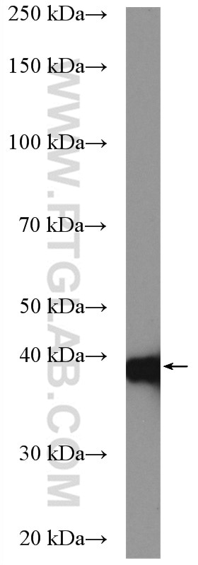 Western Blot (WB) analysis of HeLa cells using TBCC Polyclonal antibody (15917-1-AP)