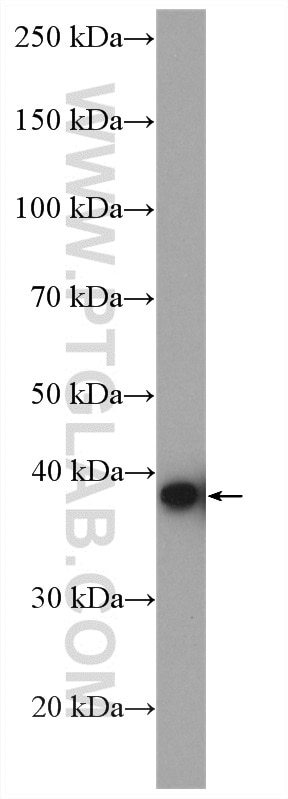 Western Blot (WB) analysis of K-562 cells using TBCC Polyclonal antibody (15917-1-AP)