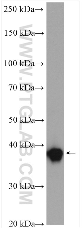 Western Blot (WB) analysis of MCF-7 cells using TBCC Polyclonal antibody (15917-1-AP)