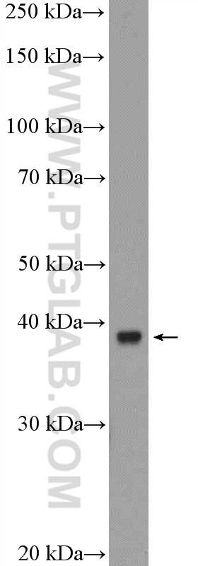 Western Blot (WB) analysis of rat liver tissue using TBCC Polyclonal antibody (15917-1-AP)