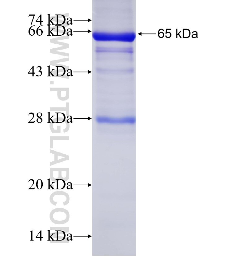 TBCC fusion protein Ag8719 SDS-PAGE