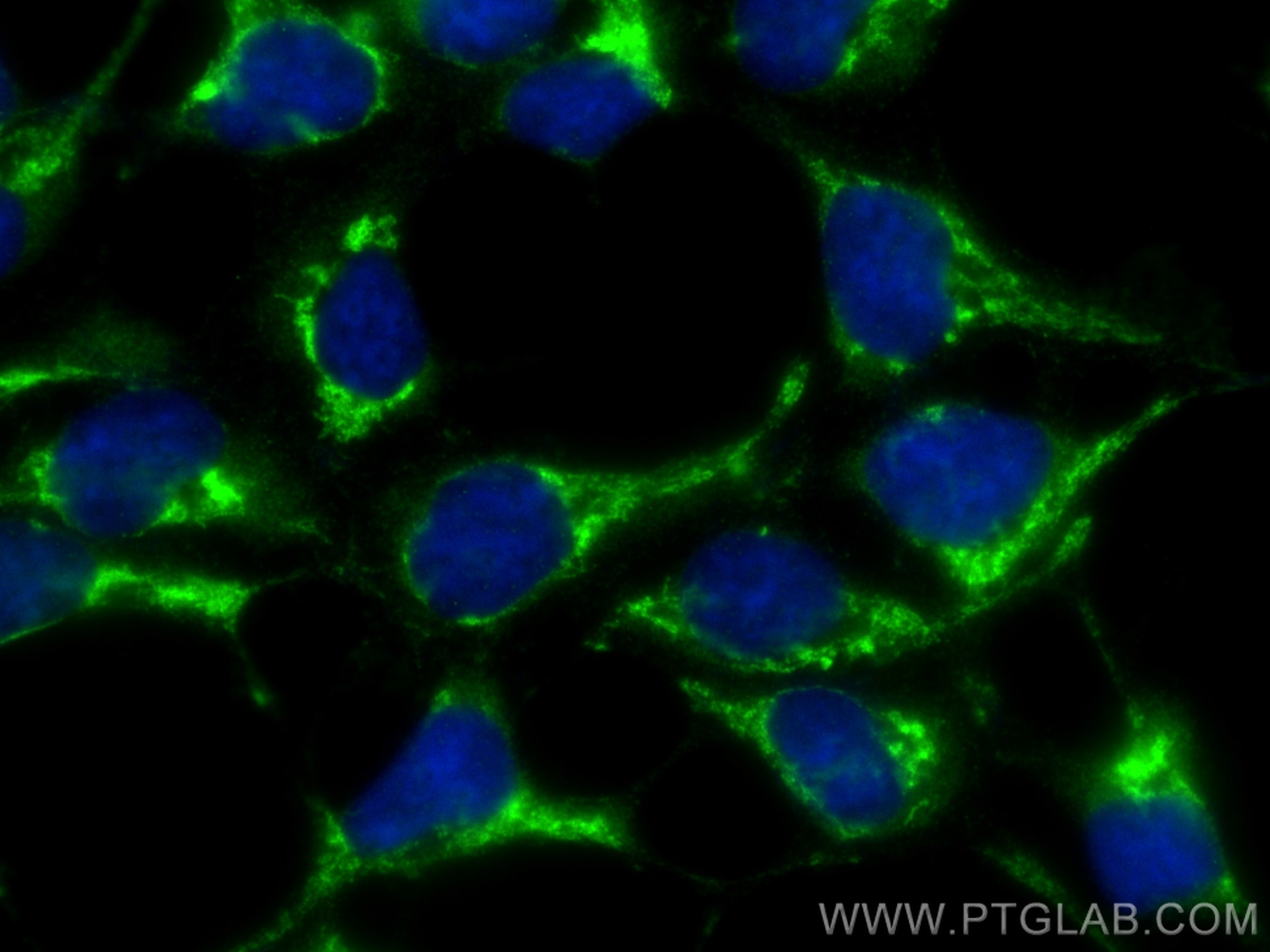 Immunofluorescence (IF) / fluorescent staining of HEK-293 cells using TBCCD1 Polyclonal antibody (21429-1-AP)