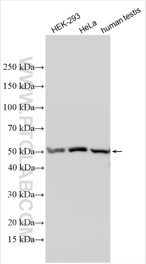 Western Blot (WB) analysis of various lysates using TBCCD1 Polyclonal antibody (21429-1-AP)