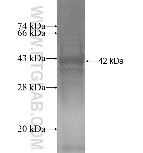 TBCCD1 fusion protein Ag16032 SDS-PAGE