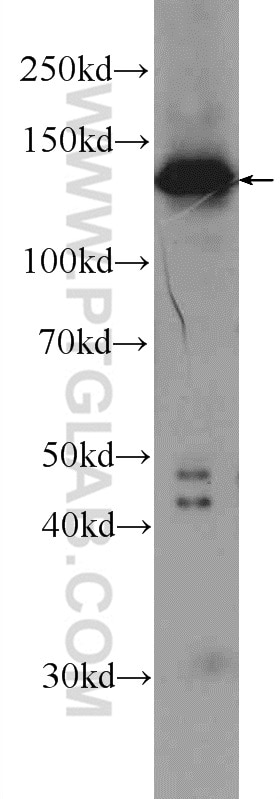 Western Blot (WB) analysis of MCF-7 cells using TBCD Polyclonal antibody (14867-1-AP)