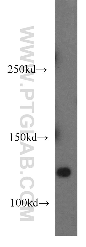 Western Blot (WB) analysis of mouse brain tissue using TBCD Polyclonal antibody (14867-1-AP)