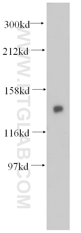 Western Blot (WB) analysis of mouse brain tissue using TBCD Polyclonal antibody (14867-1-AP)