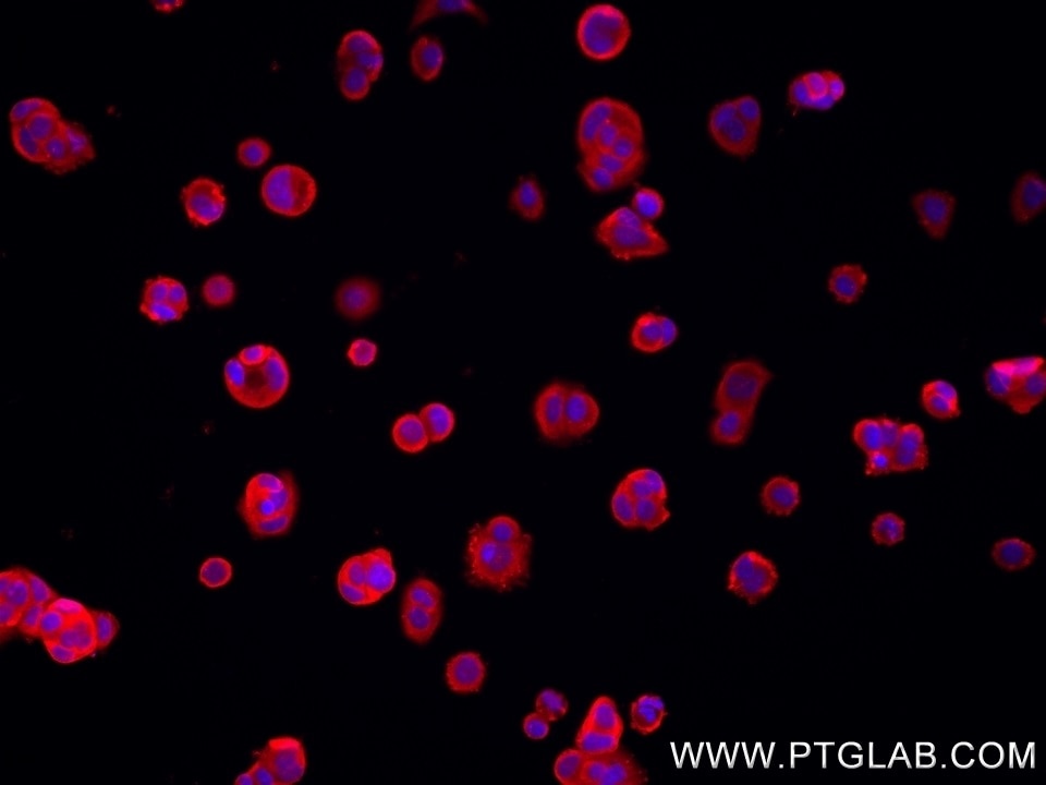 Immunofluorescence (IF) / fluorescent staining of MCF-7 cells using TBCD Recombinant antibody (82911-1-RR)
