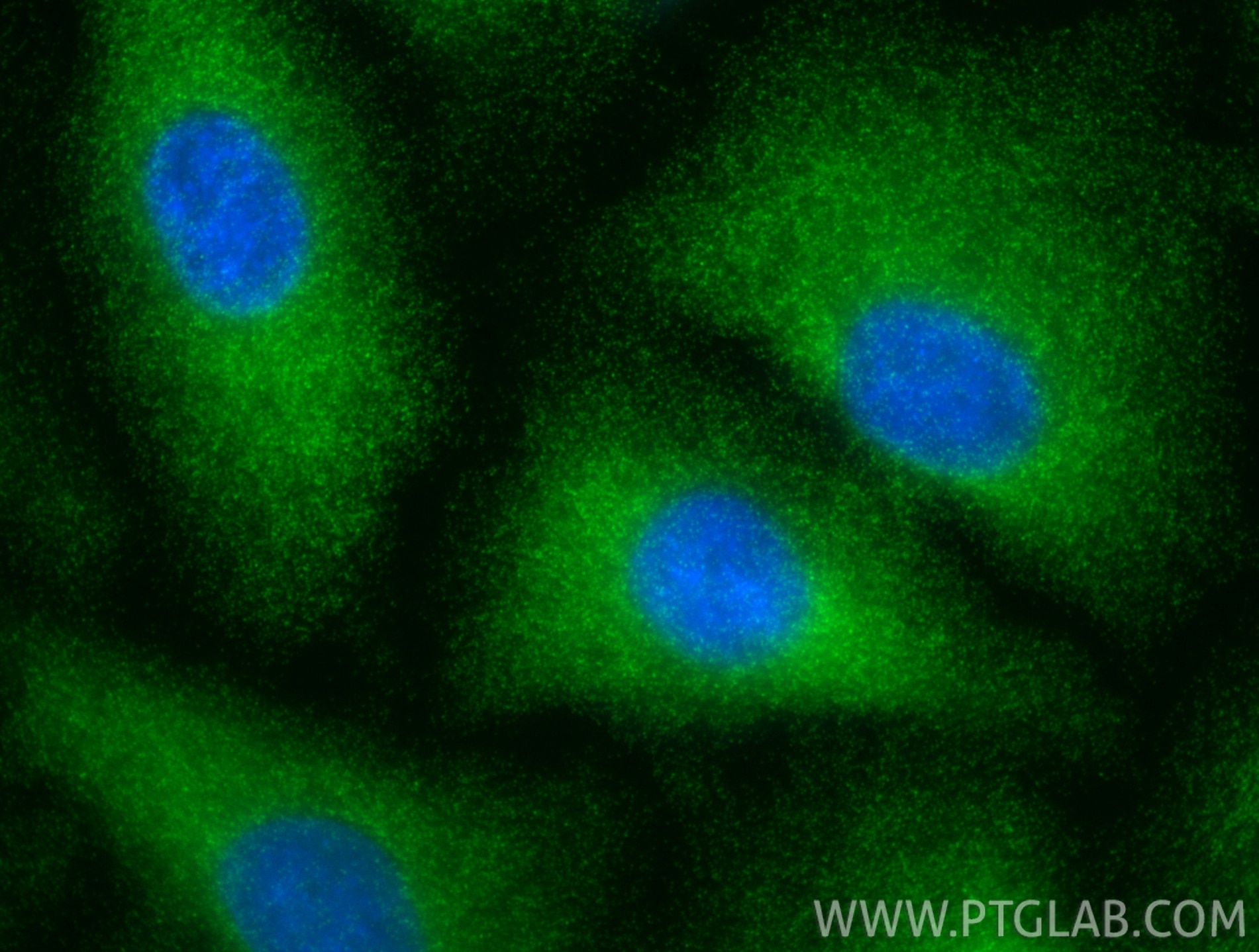 Immunofluorescent analysis of (-20°C Methanol) fixed A549 cells using TBCD antibody (82911-1-RR, Clone: 230209H7 ) at dilution of 1:400 and CoraLite®488-Conjugated Goat Anti-Rabbit IgG(H+L) (SA00013-2). Immunofluorescence (IF) / fluorescent staining of A549 cells using TBCD Recombinant monoclonal antibody (82911-1-RR)