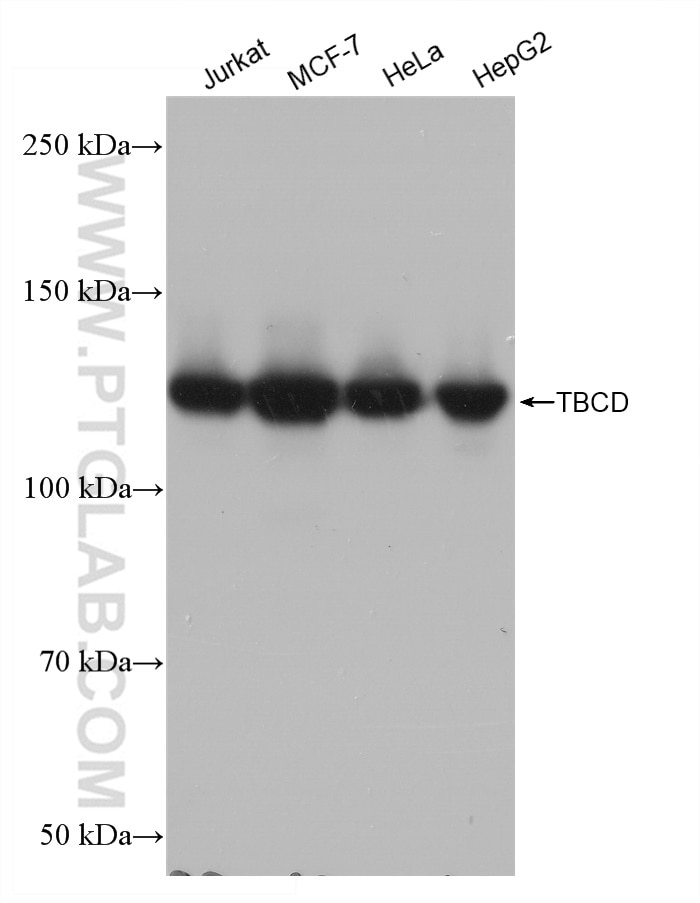 Western Blot (WB) analysis of various lysates using TBCD Recombinant antibody (82911-1-RR)