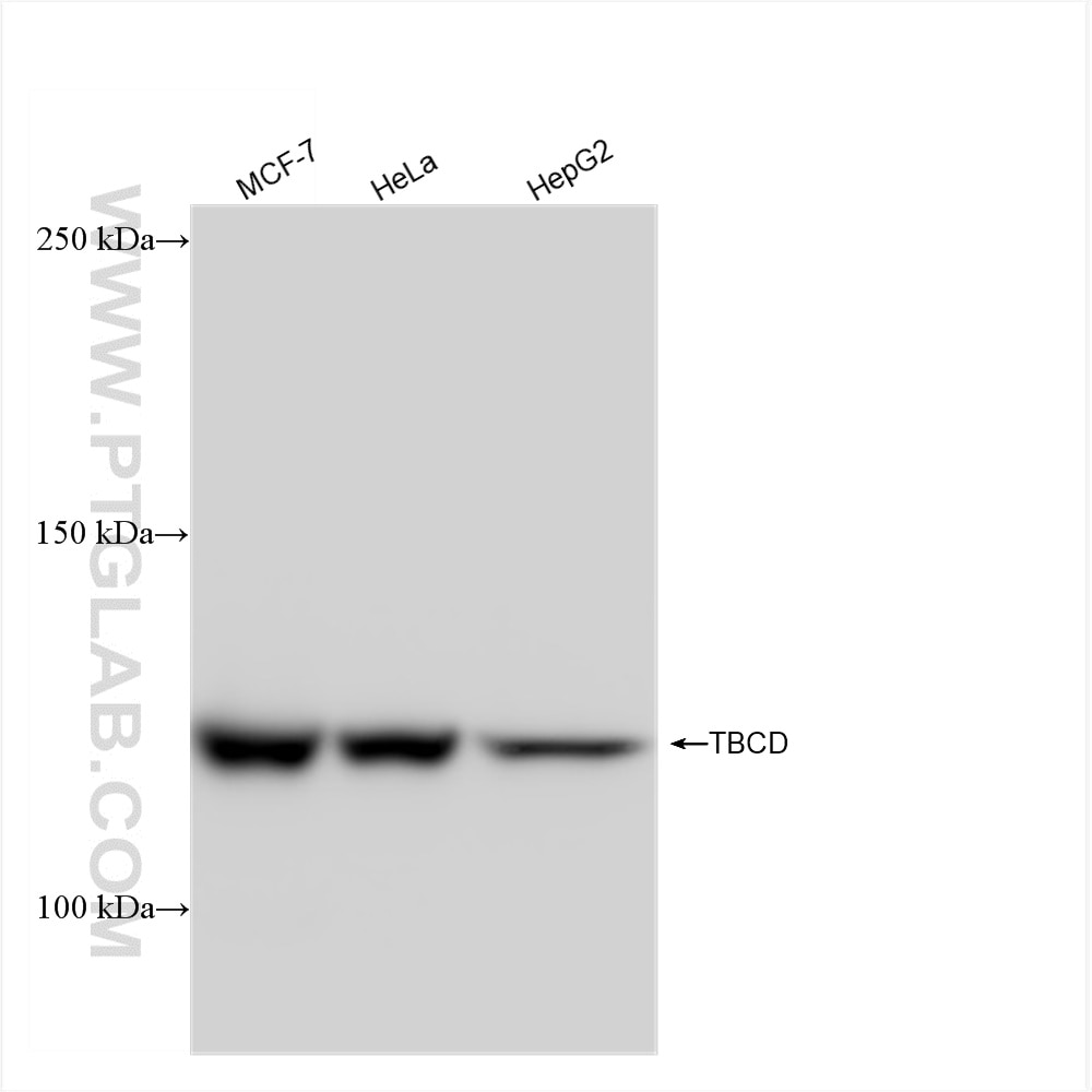 Western Blot (WB) analysis of various lysates using TBCD Recombinant antibody (82911-7-RR)