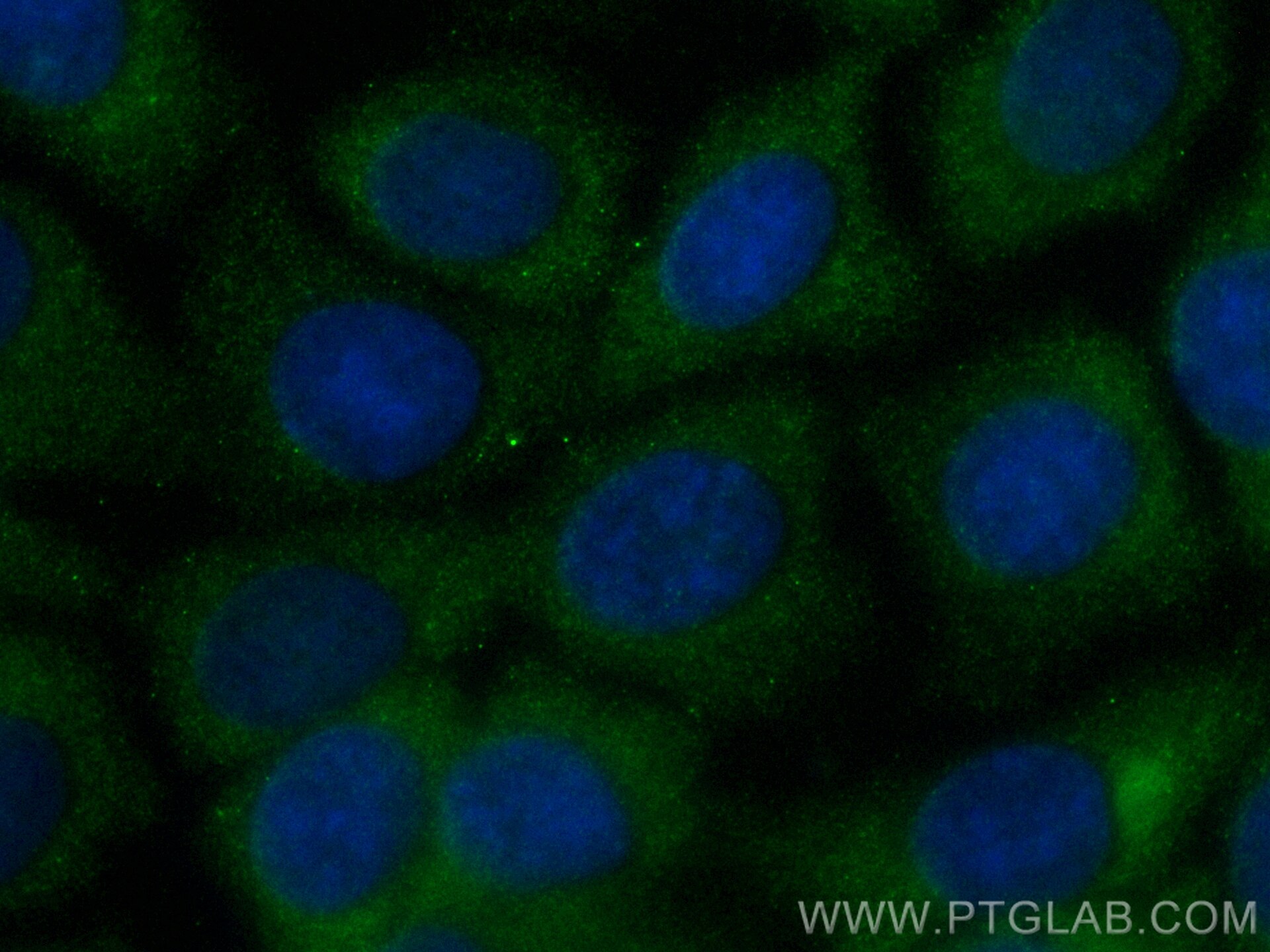 Immunofluorescence (IF) / fluorescent staining of MCF-7 cells using CoraLite® Plus 488-conjugated TBCD Recombinant ant (CL488-82911-7)