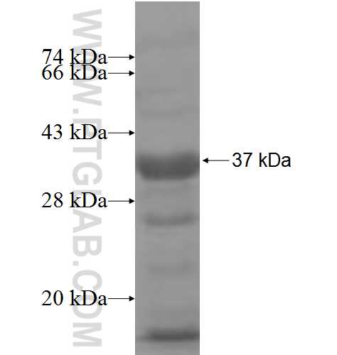 TBCD fusion protein Ag6310 SDS-PAGE