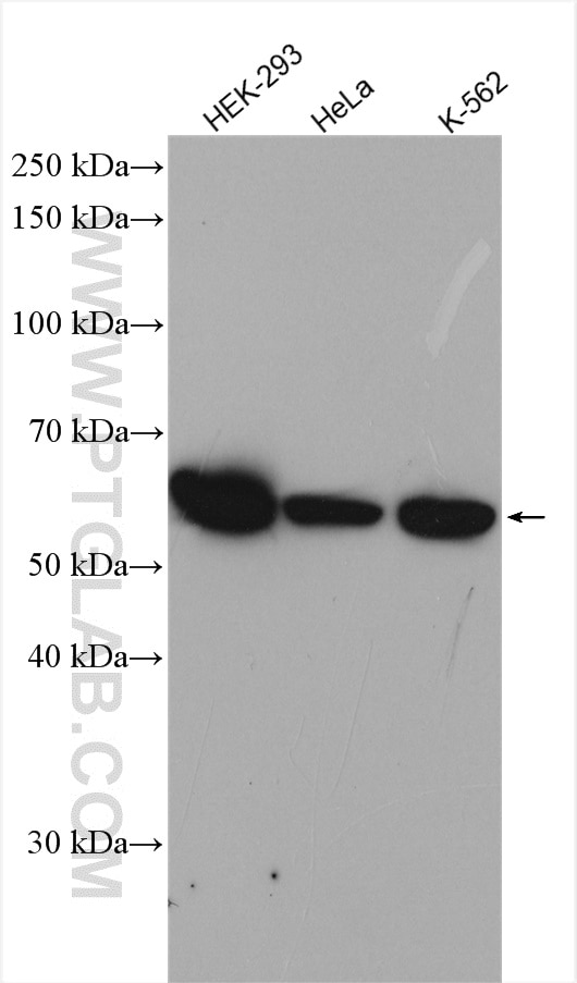 Western Blot (WB) analysis of various lysates using TBCE Polyclonal antibody (12021-1-AP)