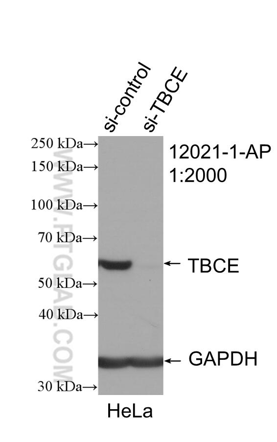 Western Blot (WB) analysis of HeLa cells using TBCE Polyclonal antibody (12021-1-AP)
