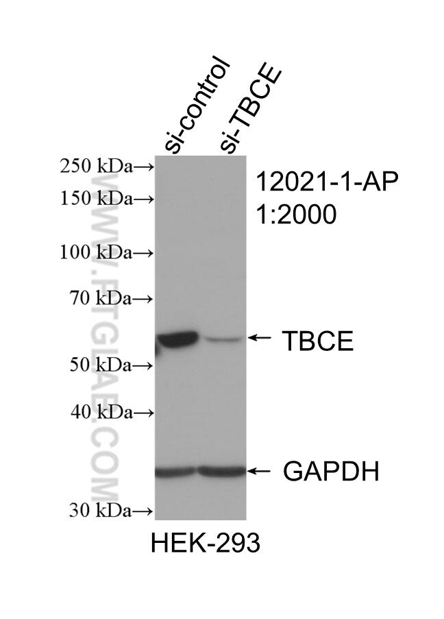 Western Blot (WB) analysis of HEK-293 cells using TBCE Polyclonal antibody (12021-1-AP)