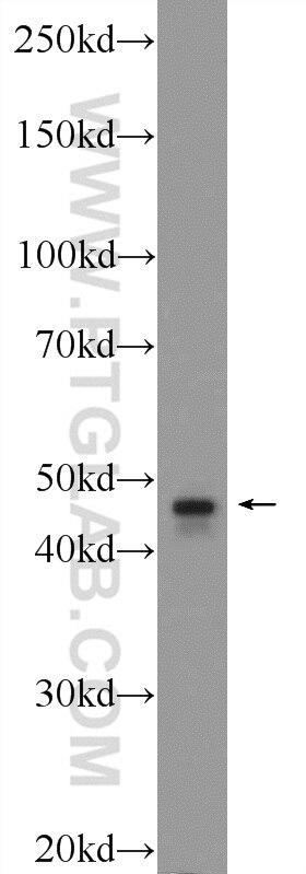 Western Blot (WB) analysis of mouse testis tissue using TBCEL Polyclonal antibody (24548-1-AP)