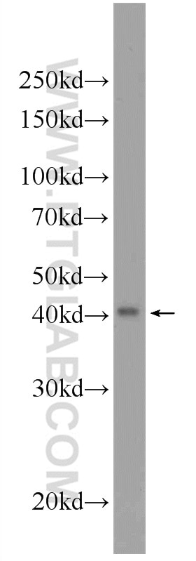 Western Blot (WB) analysis of PC-3 cells using TBCEL Polyclonal antibody (24548-1-AP)