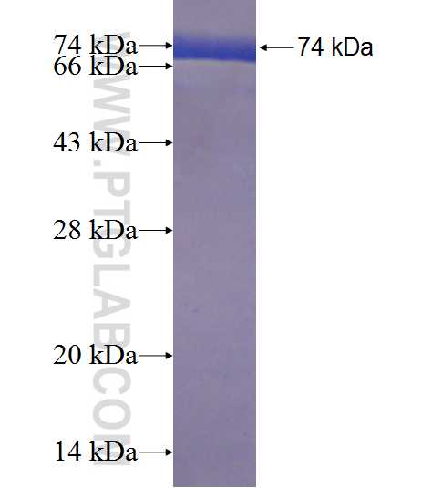 TBCEL fusion protein Ag21725 SDS-PAGE
