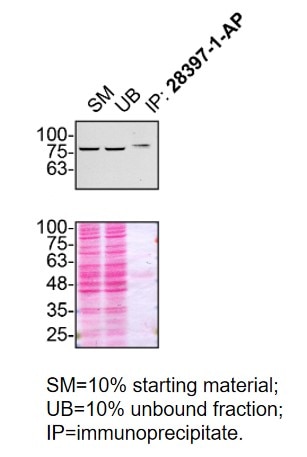 Immunoprecipitation (IP) experiment of U2OS cells using TBK1 Polyclonal antibody (28397-1-AP)