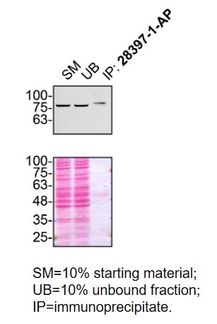 IP experiment of U2OS using 28397-1-AP
