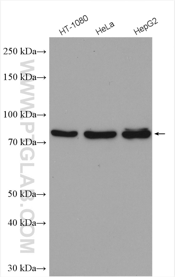 Western Blot (WB) analysis of various lysates using TBK1 Polyclonal antibody (28397-1-AP)
