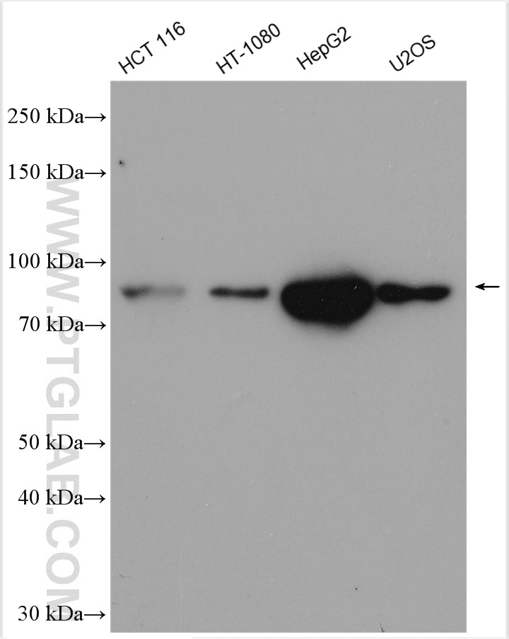 Western Blot (WB) analysis of various lysates using TBK1 Polyclonal antibody (28397-1-AP)