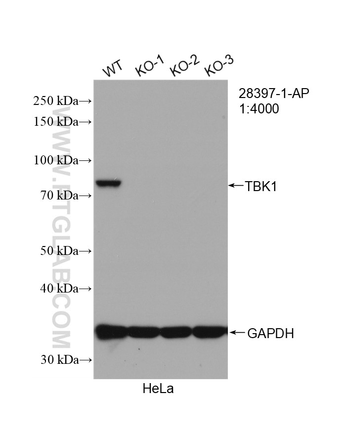 Western Blot (WB) analysis of HeLa cells using TBK1 Polyclonal antibody (28397-1-AP)